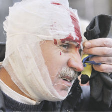 VIOLENCIA. Un ucraniano escapa de la confrontacin callejera, malherido.